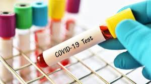 CDSCO approves 67 Indian firms for antibody rapid testing kits