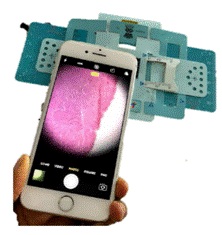Foldscope could be a better alternative to clinical microscope