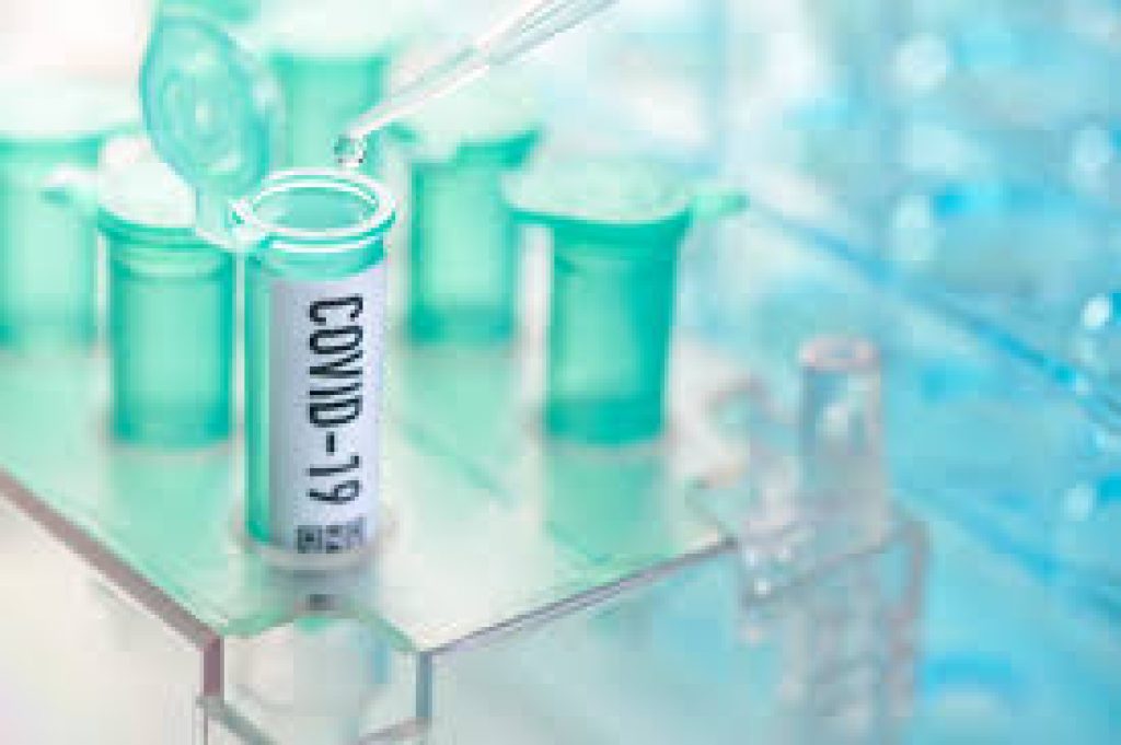 COVID KAVACH ELISA for antibody detection for COVID-19 infection