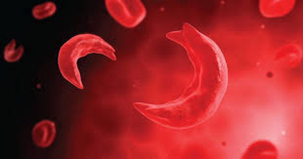 World Sickle Cell Day 2021