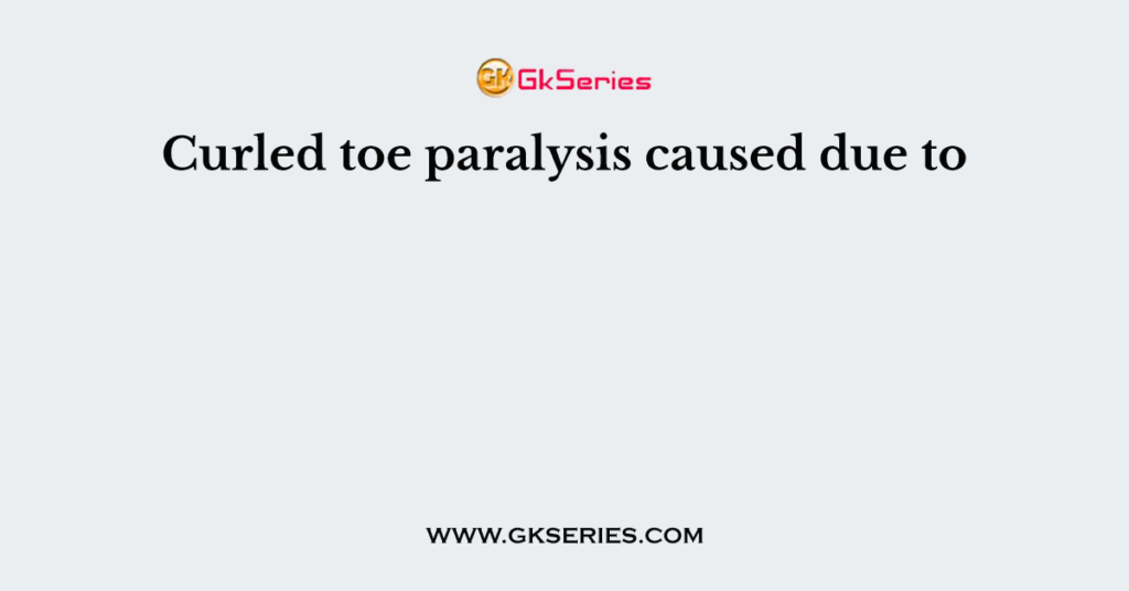 Curled toe paralysis caused due to