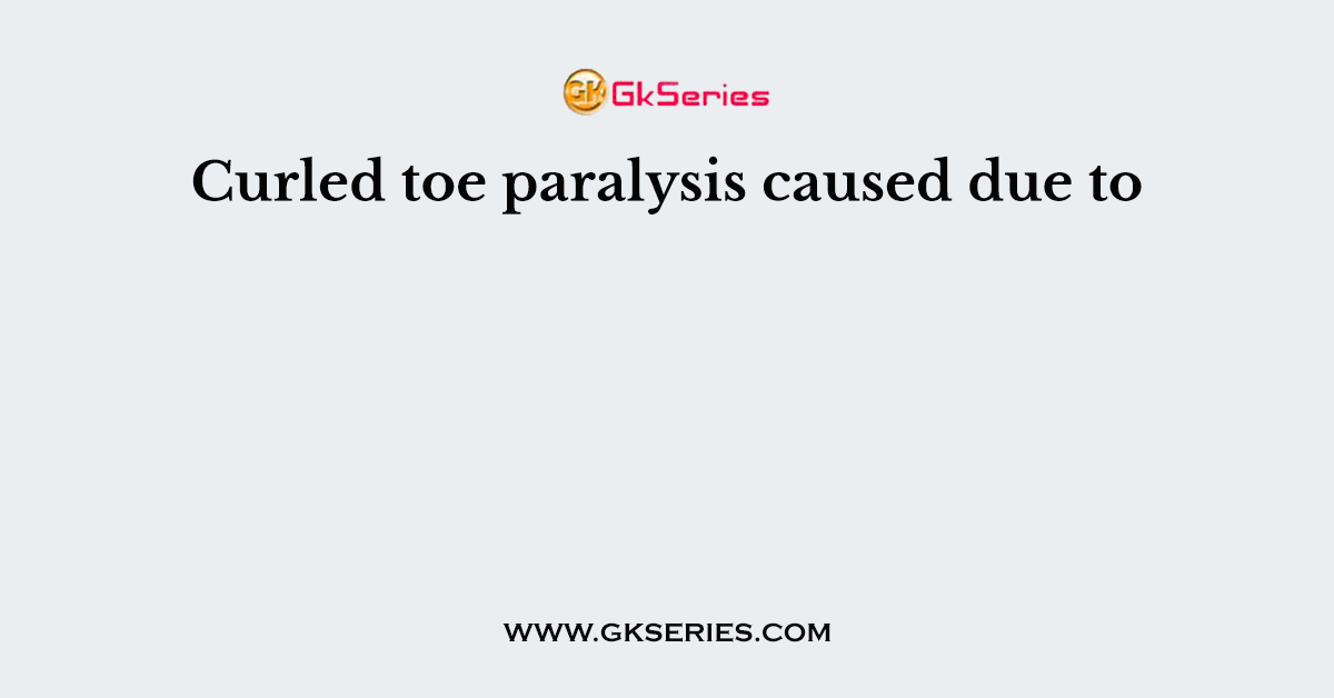 Curled toe paralysis caused due to