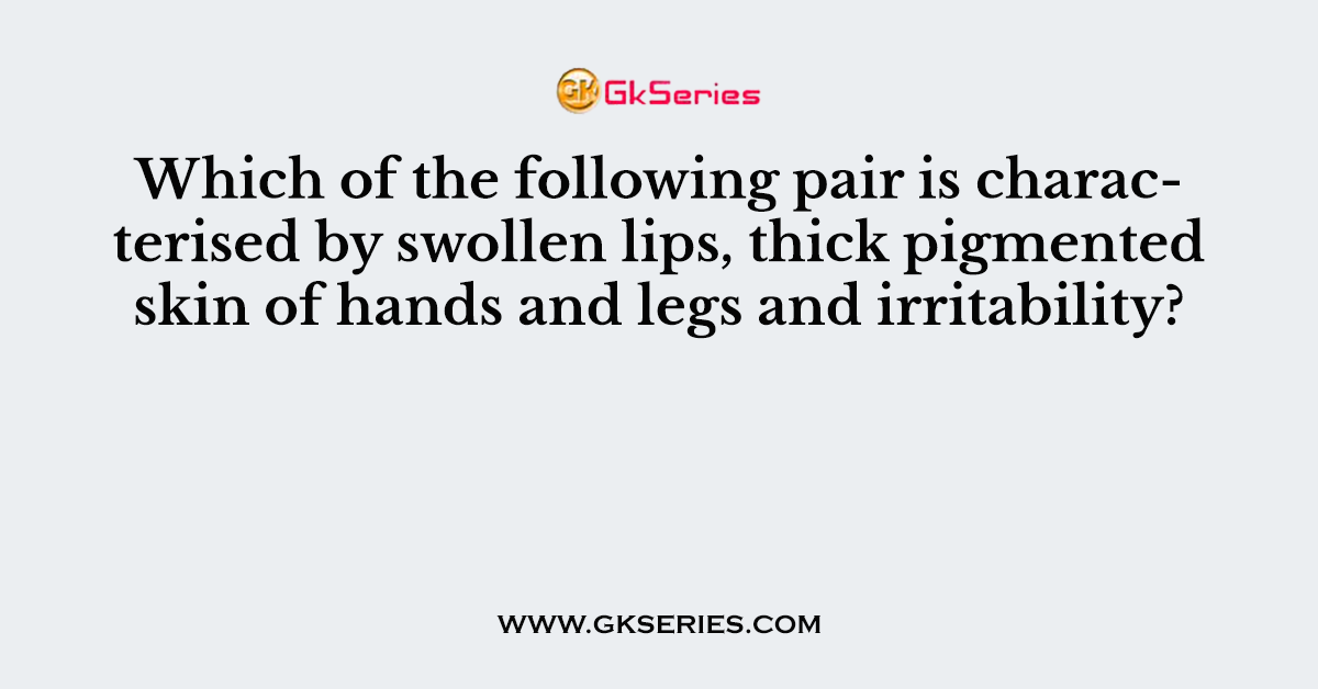 Which of the following pair is characterised by swollen lips, thick pigmented skin of hands and legs and irritability?